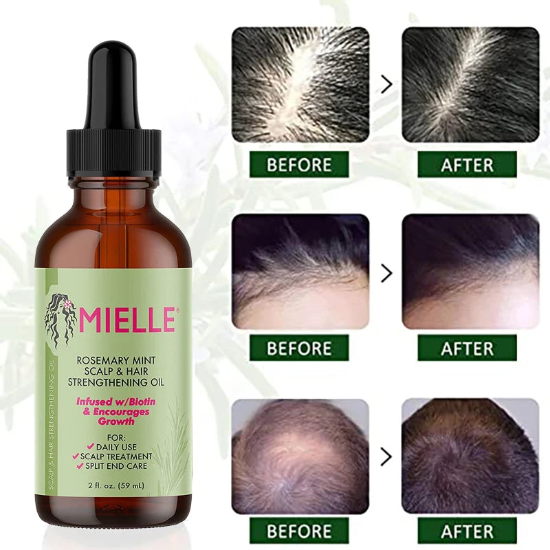 Mielle Rosemary Mint Scalp & Hair Strengthening Oil